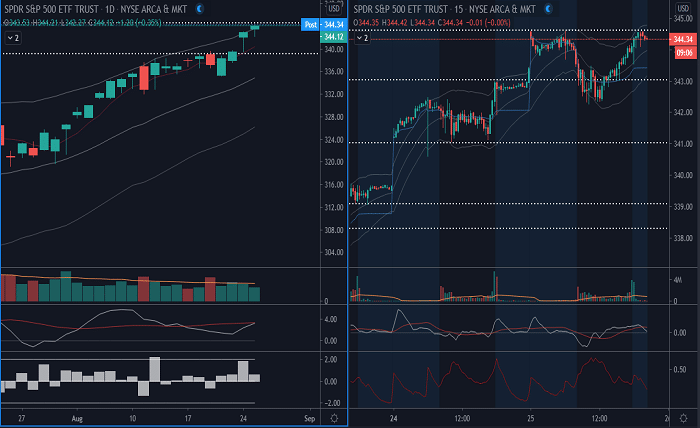 my watchlist stocks